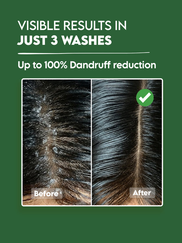 Clensta Anti-Dandruff Power Combo | Shampoo + Conditioner & Hair Serum