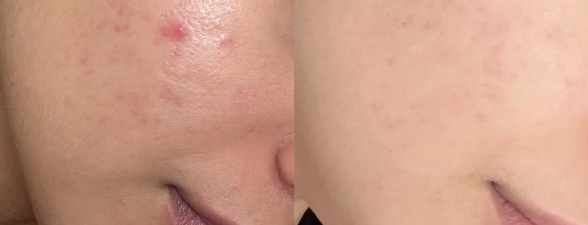 Week 1